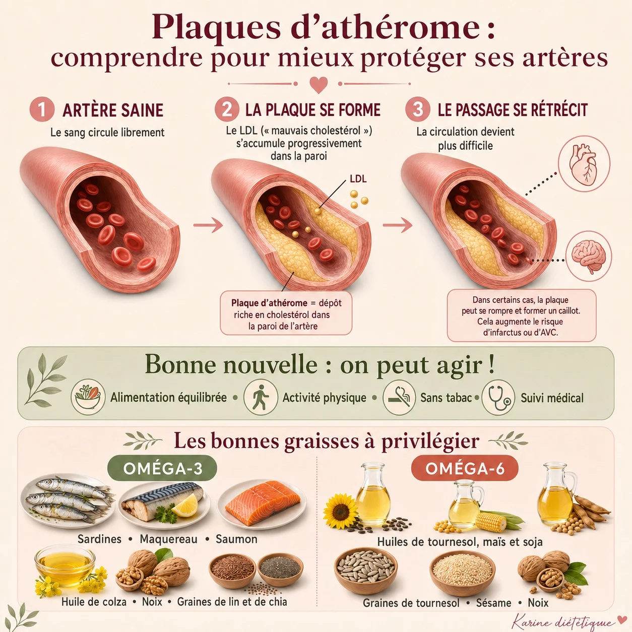 Les dangers du cholestérol